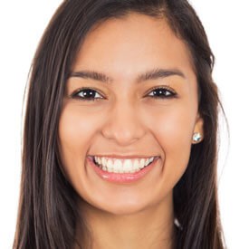 Stained Teeth